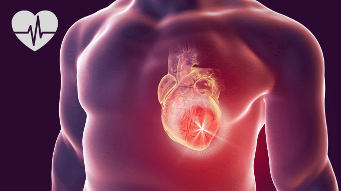 heart attack symptoms