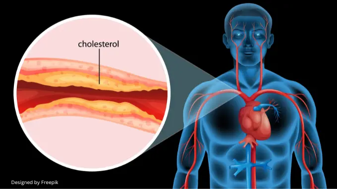 how to reduce bad cholesterol